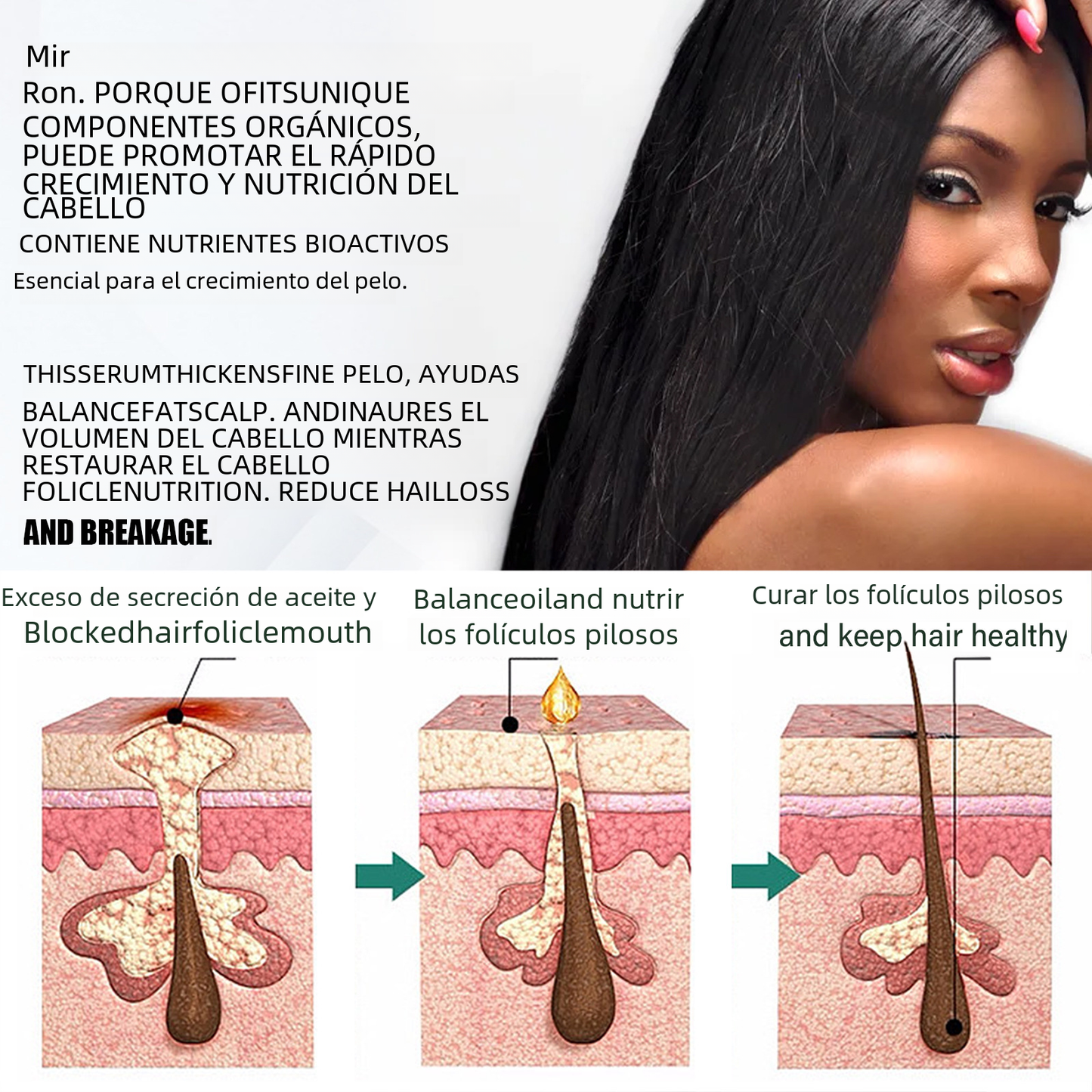 OUHOE Anti-Hair Loss Essence for Strong, Thick Hair