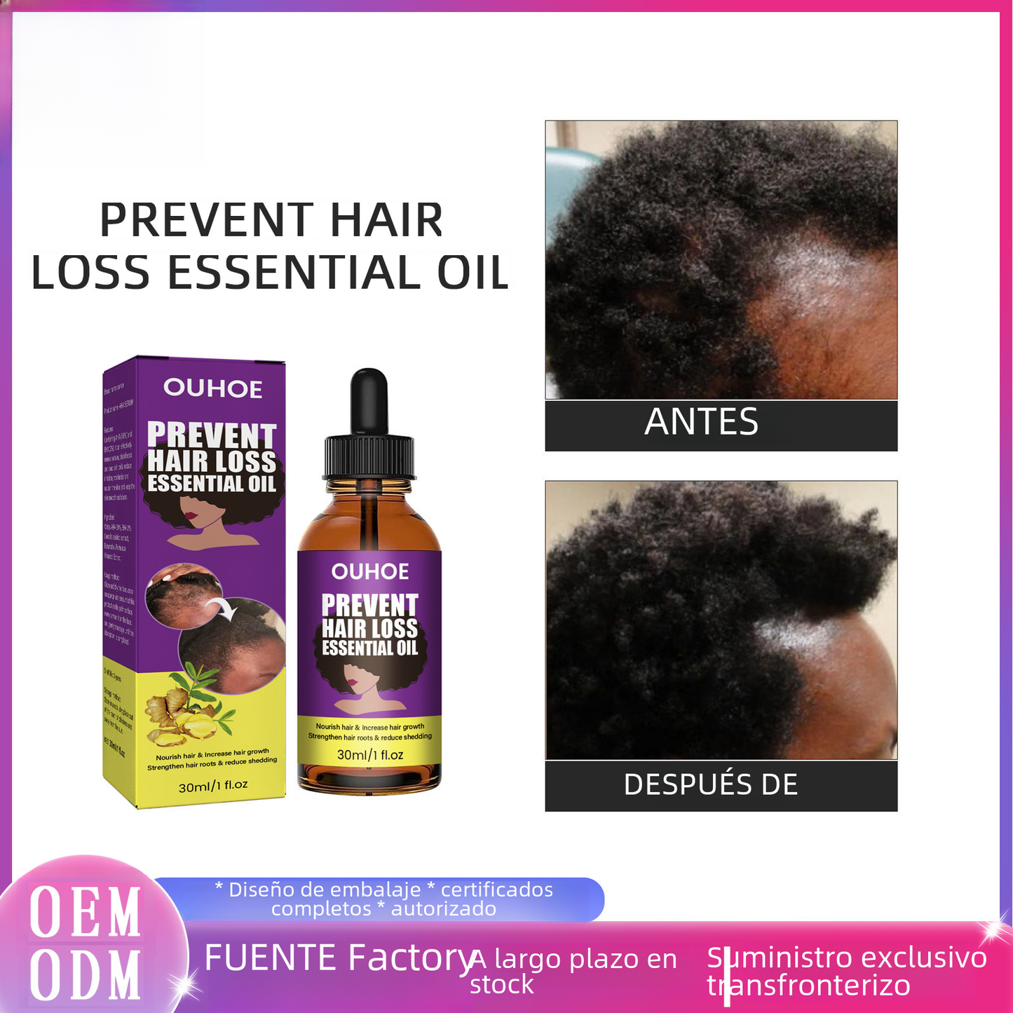 OUHOE Anti-Hair Loss Essence for Strong, Thick Hair