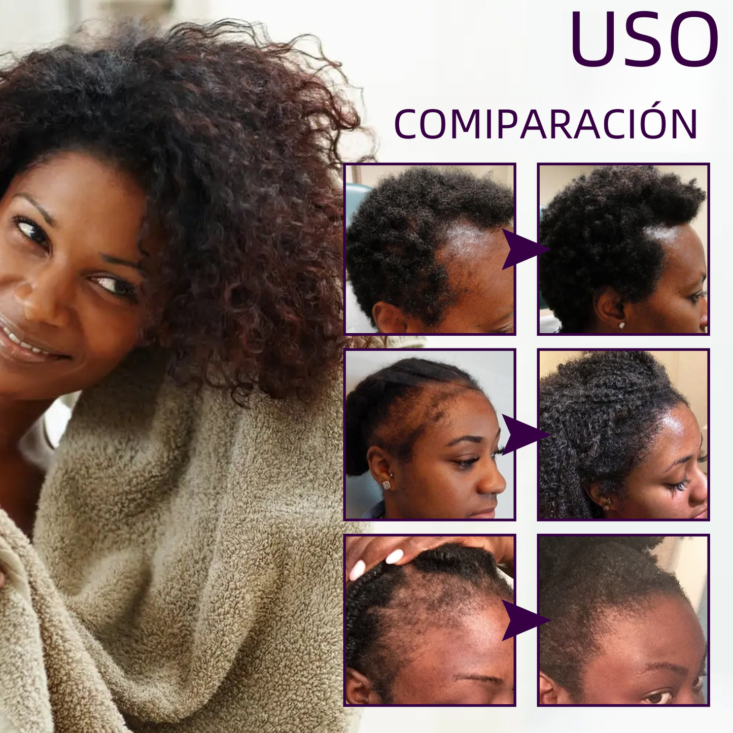 OUHOE Anti-Hair Loss Essence for Strong, Thick Hair